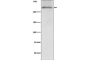 Western blot analysis of Dystrophin expression in human fetal heart lysate.