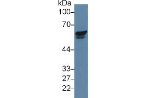 Western blot analysis of Human Jurkat cell lysate, using Human PAK2 Antibody (5 µg/ml) and HRP-conjugated Goat Anti-Rabbit antibody ( (PAK2 anticorps  (AA 177-419))