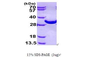 SDS-PAGE (SDS) image for 2,3-bisphosphoglycerate Mutase (BPGM) (AA 1-259) protein (His tag) (ABIN666975)