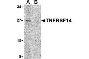 Western Blotting (WB) image for anti-Tumor Necrosis Factor Receptor Superfamily, Member 14 (TNFRSF14) (C-Term) antibody (ABIN1030760)