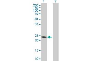 Western Blot analysis of RAB7B expression in transfected 293T cell line by RAB7B MaxPab polyclonal antibody. (RAB7B anticorps  (AA 1-199))