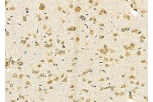 ABIN6257639 and ABIN6274782 at 1/100 staining Rat brain tissue by IHC-P. (RPL39 anticorps  (C-Term))