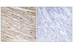 Immunohistochemistry (IHC) image for anti-phosphoprotein Enriched in Astrocytes 15 (PEA15) (pSer104) antibody (ABIN1847322) (PEA15 anticorps  (pSer104))