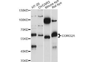 Western blot analysis of extracts of various cell lines, using CORO2A antibody (ABIN6293915) at 1:1000 dilution. (CORO2A anticorps)