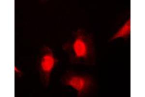 Immunofluorescent analysis of HSC70 staining in NIH3T3 cells.