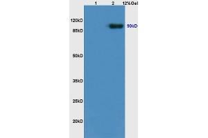 L1 rat brain lysates L2 rat kidney lysates probed with Anti Trk B/NTRK2 Polyclonal Antibody, Unconjugated (ABIN725870) at 1:200 overnight at 4 °C.