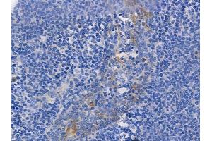 ABIN6255771 and ABIN6267262 at 1/100 staining human normal tonsil tissue by IHC-P.
