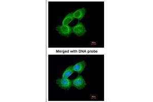 ICC/IF Image Immunofluorescence analysis of paraformaldehyde-fixed A431, using Tubulin alpha 1A, antibody at 1:200 dilution.