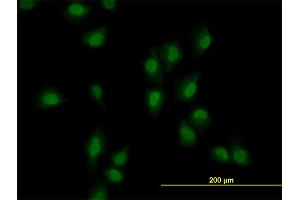 Immunofluorescence of monoclonal antibody to ARID1B on HeLa cell. (ARID1B anticorps  (AA 1364-1460))