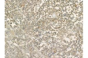 ABIN6264533 and ABIN6276573 at 1/100 staining human pituitary adenoma by IHC-P. (PYCARD anticorps  (N-Term))