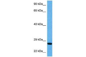 Host:  Mouse  Target Name:  BDNF  Sample Tissue:  Mouse Pancreas  Antibody Dilution:  1ug/ml (BDNF anticorps  (Middle Region))
