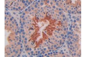 Detection of IL11Ra in Mouse Testis Tissue using Polyclonal Antibody to Interleukin 11 Receptor Alpha (IL11Ra) (IL11RA anticorps  (AA 194-329))