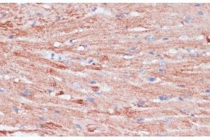 Immunohistochemistry of paraffin-embedded Mouse heart using VASP Polyclonal Antibody at dilution of 1:100 (40x lens).