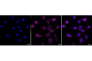 Immunocytochemical staining of HeLa cells with Forkhead box O4 antibody (ABIN7798648), 1:1,000).