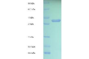 SDS-PAGE (SDS) image for RAB5C, Member RAS Oncogene Family (Rab5c) (AA 1-216), (full length) protein (His-SUMO Tag) (ABIN5710209)