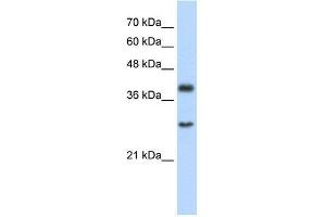 Human Jurkat; WB Suggested Anti-WDR39 Antibody Titration: 2. (CIAO1 anticorps  (C-Term))