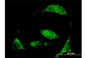 Immunofluorescence of purified MaxPab antibody to MCCC2 on HeLa cell. (MCCC2 anticorps  (AA 1-563))