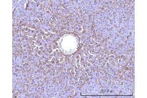 IHC analysis of RPS25 using anti-RPS25 antibody (ABIN7601567).