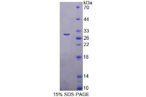 SDS-PAGE of Protein Standard from the Kit (Highly purified E. (ITGB6 Kit CLIA)