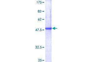 Sclerostin Domain Containing 1 (SOSTDC1) (AA 1-206) protein (GST tag)