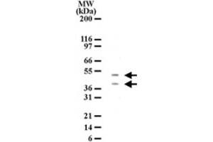 Western blot detection of HTRA2 in HL-60 cell lysate. (HTRA2 anticorps  (AA 335-350))