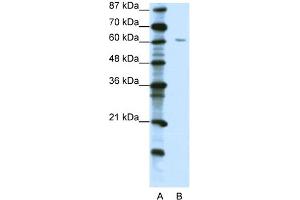 WB Suggested Anti-ZNF286 Antibody Titration:  1. (ZNF286A anticorps  (C-Term))