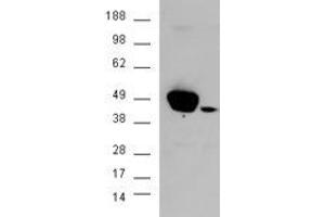 HEK293 overexpressing ERK1 and probed with ABIN2562467 (mock transfection in second lane) (ERK1 anticorps  (N-Term))