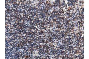 Image no. 9 for anti-Transforming, Acidic Coiled-Coil Containing Protein 3 (TACC3) antibody (ABIN1498095) (TACC3 anticorps)