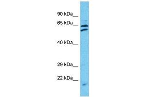 Western Blotting (WB) image for anti-Tetratricopeptide Repeat Domain 24 (TTC24) (C-Term) antibody (ABIN2791966) (TTC24 anticorps  (C-Term))
