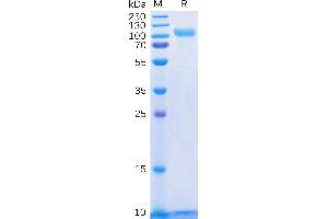Human Protein, His Tag on SDS-PAGE under reducing condition.