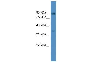 WB Suggested Anti-ING2 Antibody Titration:  0. (ING2 anticorps  (N-Term))