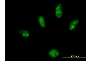 Immunofluorescence of purified MaxPab antibody to ZBTB25 on HeLa cell. (ZBTB25 anticorps  (AA 1-435))