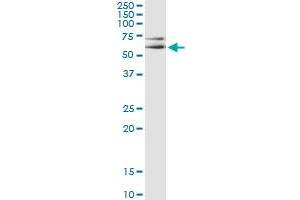 Western Blotting (WB) image for anti-Mitogen-Activated Protein Kinase 8 (MAPK8) (AA 318-428) antibody (ABIN793072) (JNK anticorps  (AA 318-428))