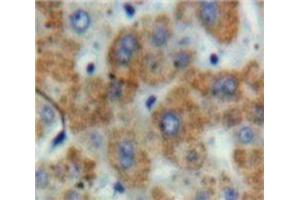 Used in DAB staining on fromalin fixed paraffin-embedded Liver tissue (TFPI anticorps  (AA 29-251))