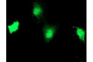Anti-TBCC mouse monoclonal antibody (ABIN2455773) immunofluorescent staining of COS7 cells transiently transfected by pCMV6-ENTRY TBCC (RC203563). (TBCC anticorps)