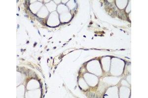 Immunohistochemistry of paraffin-embedded Human gastric using TAZ Polyclonal Antibody at dilution of 1:200 (40x lens). (TAZ anticorps)