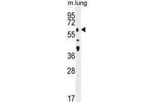 TGFBR2 Antibody (N-term) western blot analysis in mouse lung tissue lysates (35 µg/lane). (TGFBR2 anticorps  (N-Term))