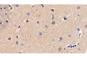 Detection of CNN1 in Human Cerebrum Tissue using Polyclonal Antibody to Calponin 1, Basic (CNN1) (CNN1 anticorps  (AA 1-268))