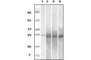 anti-RAB25, Member RAS Oncogene Family (RAB25) antibody