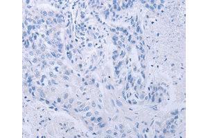 Immunohistochemistry (IHC) image for anti-Cyclin-Dependent Kinase 20 (CDK20) antibody (ABIN1871721) (CCRK anticorps)