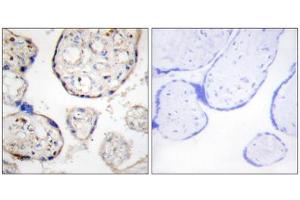 Immunohistochemistry analysis of paraffin-embedded human placenta tissue, using STEAP4 antibody. (STEAP4 anticorps  (Internal Region))