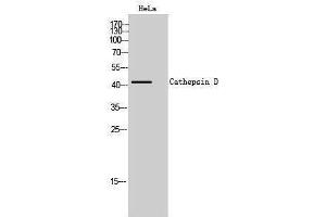 Western Blotting (WB) image for anti-Cathepsin D (CTSD) (Internal Region) antibody (ABIN3183691) (Cathepsin D anticorps  (Internal Region))