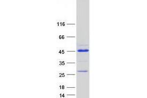 Validation with Western Blot