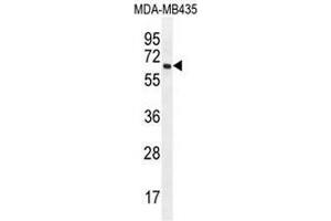PRAMEF20 Antibody (C-term) western blot analysis in MDA-MB435 cell line lysates (35µg/lane). (PRAMEF20 anticorps  (C-Term))
