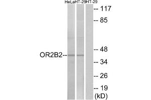 Western blot analysis of extracts from HeLa cells and HT-29 cells, using OR2B2 antibody. (OR2B2 anticorps  (Internal Region))