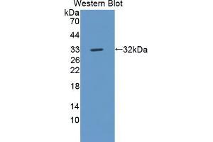 Western blot analysis of the recombinant protein. (ROS1 anticorps  (AA 1937-2210))