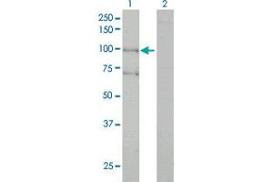 Western Blot analysis of ALS2 expression in transfected 293T cell line by ALS2 monoclonal antibody (M01), clone 4F9. (ALS2 anticorps  (AA 221-320))