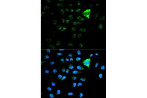 Immunofluorescence analysis of MCF-7 cells using CDKN1A antibody. (p21 anticorps)