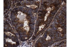 Image no. 7 for anti-Asialoglycoprotein Receptor 2 (ASGR2) antibody (ABIN1496744)