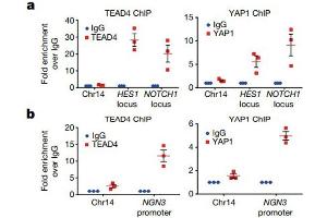 Abnormal tip-trunk patterning and impaired differentiation in Yap1 transgenic pancreas.